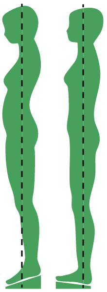 MinusabsatzLot